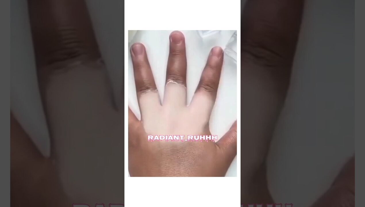 Dark Hands? Try This😳✨#remedy #diy #skincare #handcare #fypシ #shorts