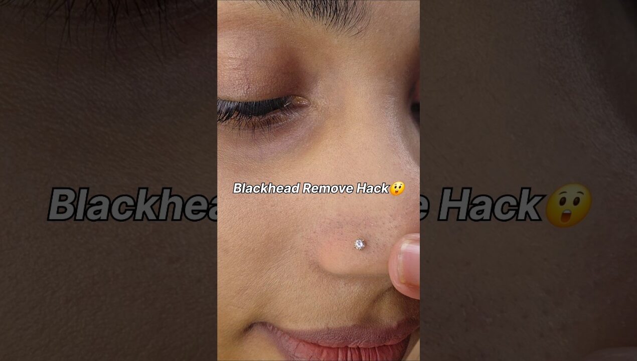 Quick fix for your blackheads 😱 #hack #diy#homemade#shorts #quickhack#blackheads#ashortaday