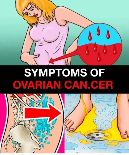 The Genetic Thread: Decoding the Deep Link Between Breast and Ovarian Cancer