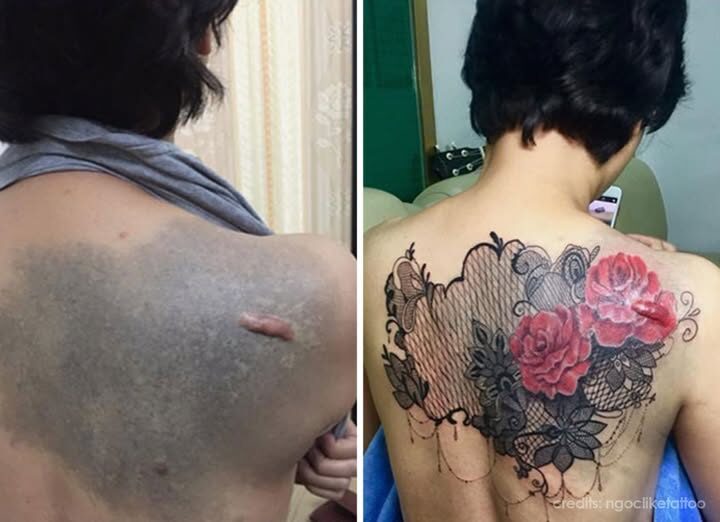 Beyond Ink: How One Tattoo Artist is Healing Lives by Transforming Scars into Art