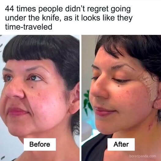 Architectural Rescues: 5 Incredible Before & After Building “Facelifts” That Saved Distressed Structures