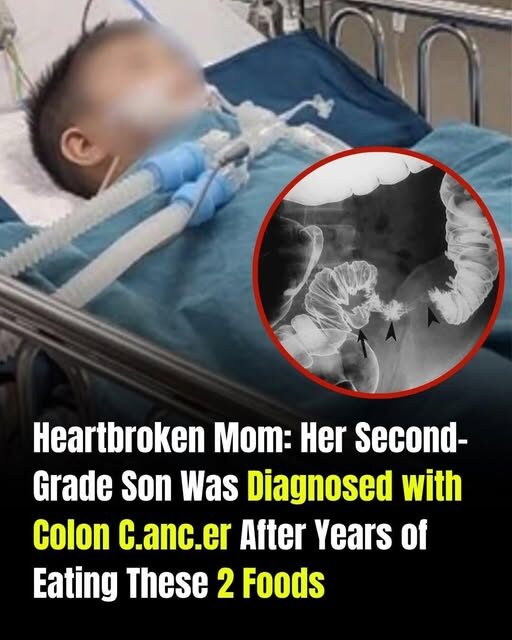 A Family’s Wake-Up Call: Teen Diagnosed With Colon Cancer After Years of Poor Dietary Choices