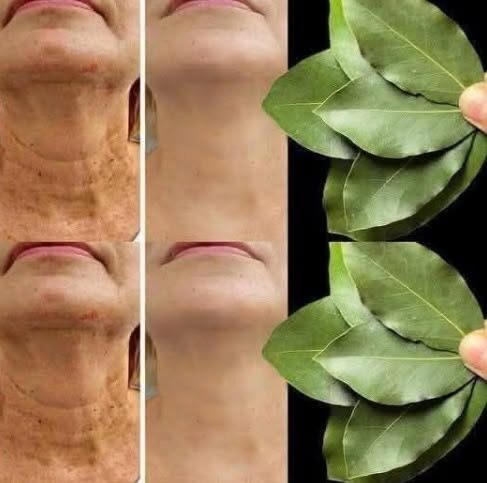 Spicing Up the Truth: Why the “Bay Leaf is Stronger Than Botox” Trend is Pure Science Fiction