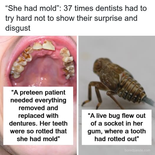 Behind the Mask: The Most Mind-Boggling Dental Disasters That Left Professionals Stunned