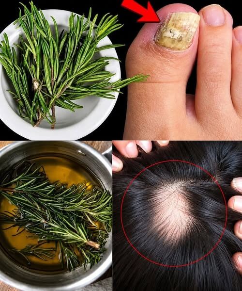 The Rosemary Remedy: Separating Fact from Fiction for Scalp, Nail, and Foot Care