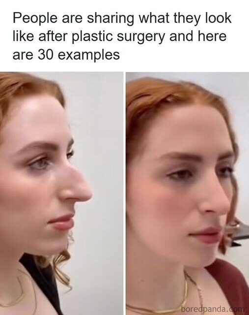The Power of Modern Surgery: Mind-Blowing “Before and After” Transformations That Look Unbelievably Natural
