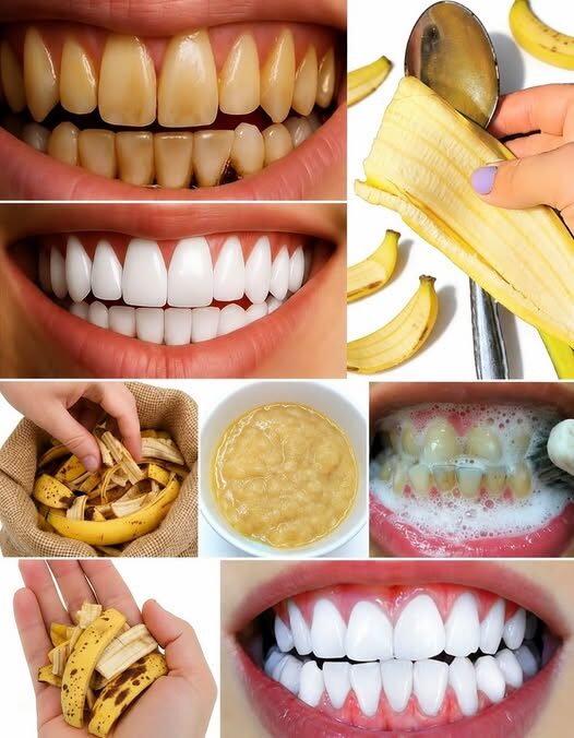 Trash to Treasure: The Ultimate Guide to Banana Peel Water for Radiant Skin & Stronger Hair