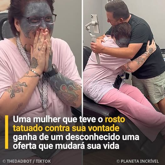 Marked by Cruelty, Healed by Kindness: The Unforgettable Journey of a Woman Reclaiming Her Face